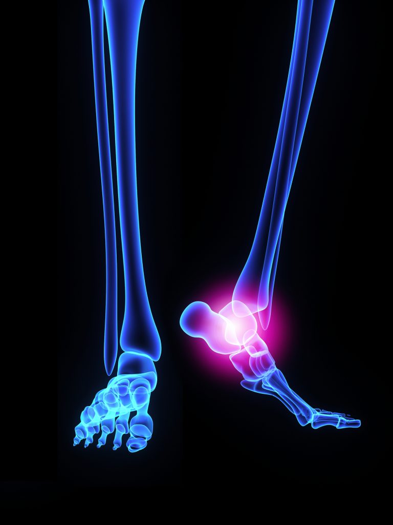 Proprioception System